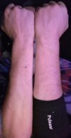 tendonitis.jpg